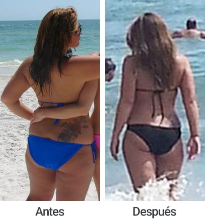Erica antes y después